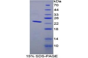 SDS-PAGE analysis of Rat TNNI2 Protein. (TNNI2 Protein)