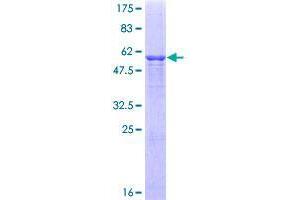 Image no. 1 for C1q and Tumor Necrosis Factor Related Protein 1 (C1QTNF1) (AA 26-281) protein (GST tag) (ABIN1347378) (C1QTNF1 Protein (AA 26-281) (GST tag))