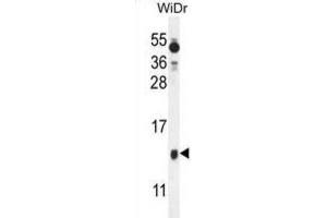 Western Blotting (WB) image for anti-Brain Expressed, X-Linked 1 (BEX1) antibody (ABIN2995790) (BEX1 Antikörper)
