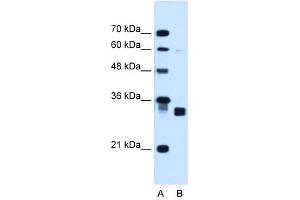 Carbonyl Reductase 1 antibody used at 1. (CBR1 Antikörper  (C-Term))