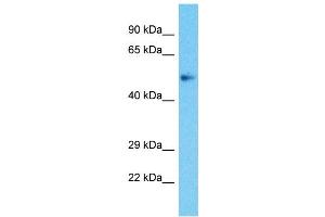 Host:  Rabbit  Target Name:  ZBTB25  Sample Type:  Uterus Tumor lysates  Antibody Dilution:  1. (ZBTB25 Antikörper  (Middle Region))