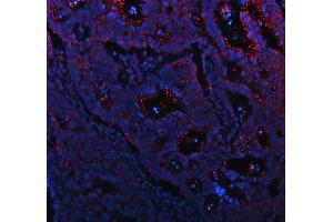 IF analysis of AMUC13 using anti-MUC13 antibody (ABIN6719597).