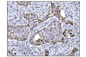IHC analysis of DLGAP1 using anti-DLGAP1 antibody (ABIN7600257).