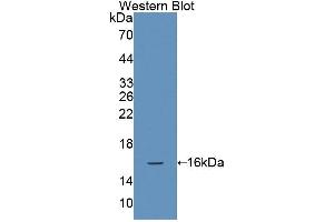 Western blot analysis of the recombinant protein. (NCR3 Antikörper  (AA 22-135))