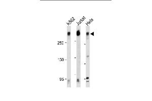 All lanes : Anti-PCM-1 Antibody (C-term) at 1:500-2000 dilution Lane 1: K562 whole cell lysate Lane 2: Jurkat whole cell lysate Lane 3: Hela whole cell lysate Lysates/proteins at 20 μg per lane. (PCM1 Antikörper  (C-Term))
