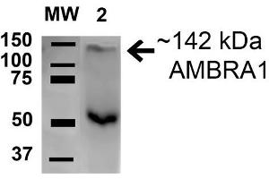 Western blot analysis of Rat Brain cell lysates showing detection of 142. (AMBRA1 Antikörper  (AA 200-300) (Alkaline Phosphatase (AP)))