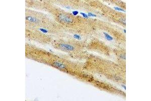 Immunohistochemical analysis of HAX1 staining in mouse heart formalin fixed paraffin embedded tissue section.