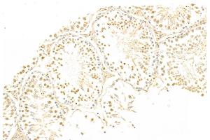ABIN6265200 and ABIN6269069 at 1/100 staining Rat testis tissue by IHC-P. (SNAIL Antikörper  (C-Term))