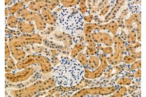 anti-Complement Factor H (CFH) (N-Term) antibody