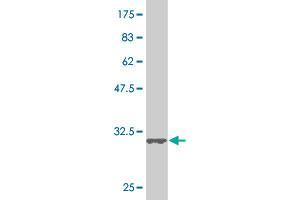 Western Blot detection against Immunogen (34. (SMAD5 Antikörper  (AA 105-182))
