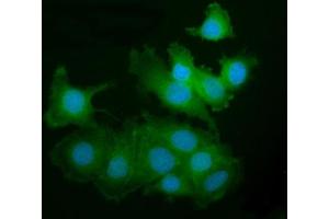 IF analysis of PAK2 using anti-PAK2 antibody (ABIN7599219). (PAK2 Antikörper  (AA 1-288))