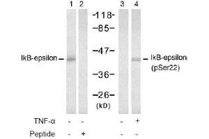 Image no. 2 for anti-Nuclear Factor of kappa Light Polypeptide Gene Enhancer in B-Cells Inhibitor, epsilon (NFKBIE) (pSer22) antibody (ABIN196948) (NFKBIE Antikörper  (pSer22))