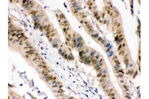 IHC analysis of ZBTB7A using anti-ZBTB7A antibody (ABIN3044568).