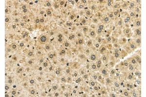 ABIN6261609 and ABIN6277954 at 1/100 staining Mouse liver tissue by IHC-P.