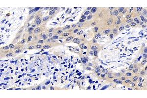 Immunohistochemistry (IHC) image for anti-Caspase 8 (CASP8) (AA 385-479) antibody (ABIN7437074)