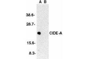 Western blot analysis of CIDE-A in human brain tissue lysate in the absence (A) or presence (B) of peptide with AP30229PU-N CIDE-A antibody at 1/2000 dilution. (CIDEA Antikörper  (C-Term))