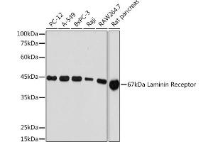 Western blot analysis of extracts of various cell lines, using 67 kDa Laminin Receptor Rabbit mAb (ABIN7270042) at 1:1000 dilution. (RPSA/Laminin Receptor Antikörper)