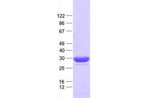 Validation with Western Blot (C11orf54 Protein (His tag))