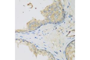 Immunohistochemistry of paraffin-embedded human prostate using LLGL2 antibody (ABIN5975836) at dilution of 1/200 (40x lens). (LLGL2 Antikörper)