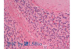 ABIN1590014 (5µg/ml) staining of paraffin embedded Human Cerebellum. (ZNRF1 Antikörper  (Internal Region))
