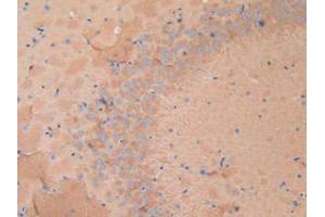 Figure. (Dynamin 1 Antikörper  (AA 572-745))