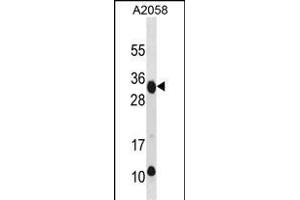 RAET1E Antibody (Center) (ABIN1881724 and ABIN2838636) western blot analysis in  cell line lysates (35 μg/lane). (Retinoic Acid Early Transcript 1E (RAET1E) (AA 150-179) Antikörper)