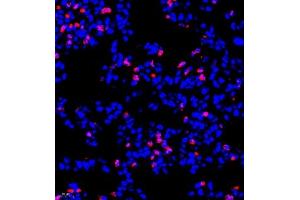 Immunofluorescence (Paraffin-embedded Sections) (IF (p)) image for anti-CD177 Molecule (CD177) antibody (ABIN7073372)