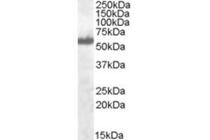 Western Blotting (WB) image for anti-Interferon Regulatory Factor 5 (IRF5) (C-Term) antibody (ABIN2465234)
