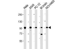 All lanes : Anti-PCSK1 Antibody (C-Term) at 1:2000 dilution Lane 1: Hela whole cell lysate Lane 2: A549 whole cell lysate Lane 3: PC-12 whole cell lysate Lane 4: mouse brain lysate Lane 5: NCI- whole cell lysate Lysates/proteins at 20 μg per lane. (PCSK1 Antikörper  (AA 682-715))
