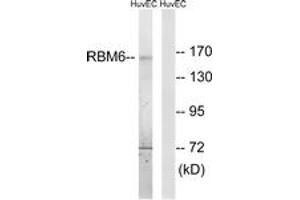 Western blot analysis of extracts from HuvEc cells, using RBM6 Antibody. (RBM6 Antikörper  (AA 991-1040))
