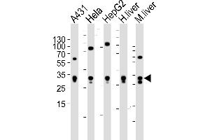 Western blot analysis of lysates from A431, Hela, HepG2 cell line , human liver and mouse liver tissue lysate(from left to right), using ETFA Antibody (Center) (ABIN6243648 and ABIN6577412). (ETFA Antikörper  (AA 192-226))