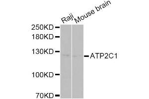 Western blot analysis of extracts of various cell lines, using ATP2C1 Antibody. (ATP2C1 Antikörper)