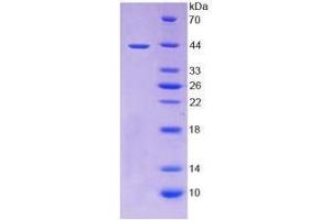 Image no. 1 for Tumor Necrosis Factor Receptor Superfamily, Member 12A (TNFRSF12A) (AA 24-126) (Active) protein (His tag,GST tag) (ABIN6239776)