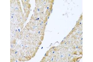 Immunohistochemistry of paraffin-embedded Mouse heart using COX6B1 Polyclonal Antibody at dilution of 1:100 (40x lens). (COX6B1 Antikörper)