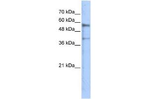 WB Suggested Anti-KREMEN1 Antibody Titration: 0. (KREMEN1 Antikörper  (N-Term))