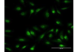 Immunofluorescence of monoclonal antibody to OLIG1 on HeLa cell.