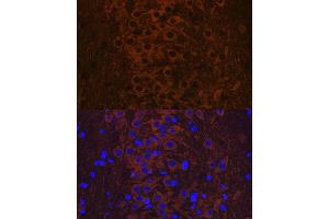 Immunofluorescence analysis of rat brain using Phospho-Tau-T231 antibody (ABIN7268531). (MAPT Antikörper  (pThr231))