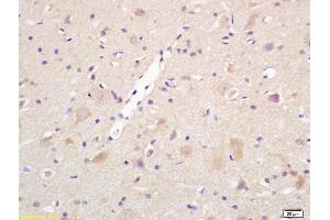 Formalin-fixed and paraffin embedded rat brain labeled with Rabbit Anti Centaurin alpha 1 Polyclonal Antibody, Unconjugated (ABIN1386169) at 1:200 followed by conjugation to the secondary antibody and DAB staining