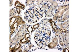 IHC-P testing of rat kidney tissue (WISP1 Antikörper  (C-Term))