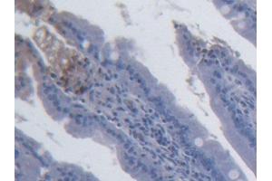 DAB staining on IHC-P; Samples: Rat Small intestine Tissue (IL-15 Antikörper  (AA 49-162))