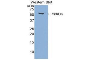 Western Blotting (WB) image for anti-Transglutaminase 1, Keratinocyte (TGM1) (AA 562-800) antibody (ABIN1860738) (TGM1 Antikörper  (AA 562-800))