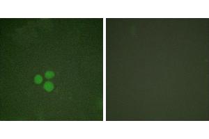 Forskolin + -Immunofluorescence analysis of HeLa cells, treated with Forskolin (40nM, 30mins), using DP-1 antibody. (TGM4 Antikörper)