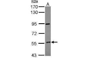 CYP4F12 Antikörper  (Center)