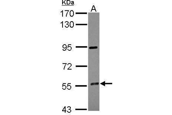 CYP4F12 Antikörper  (Center)