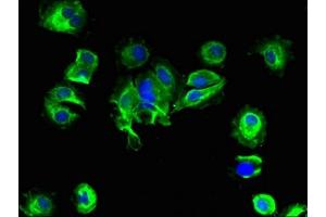 Immunofluorescent analysis of MCF-7 cells using ABIN7145717 at dilution of 1:100 and Alexa Fluor 488-congugated AffiniPure Goat Anti-Rabbit IgG(H+L) (SLC25A14 Antikörper  (AA 55-111))