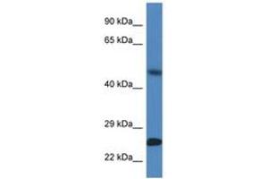 Image no. 1 for anti-Sorting Nexin 10 (SNX10) (AA 100-149) antibody (ABIN6747387) (SNX10 Antikörper  (AA 100-149))
