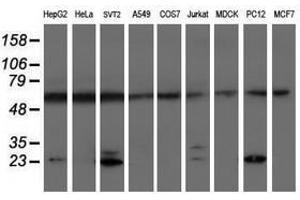 Image no. 2 for anti-Proteasome (Prosome, Macropain) Subunit, beta Type, 9 (Large Multifunctional Peptidase 2) (PSMB9) (AA 21-219) antibody (ABIN1491192) (PSMB9 Antikörper  (AA 21-219))