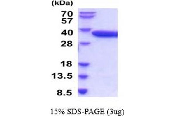 ACP5 Protein (AA 22-325) (His tag)