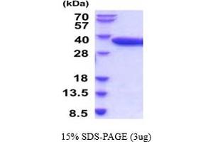 SDS-PAGE (SDS) image for Acid Phosphatase 5, Tartrate Resistant (ACP5) (AA 22-325) (Active) protein (His tag) (ABIN5854325) (ACP5 Protein (AA 22-325) (His tag))