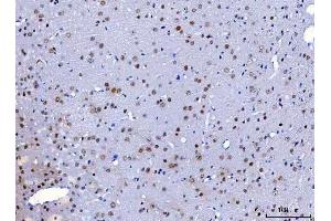 IHC analysis of HnRNP H/HNRNPH1 using anti-HnRNP H/HNRNPH1 antibody (ABIN4886623).